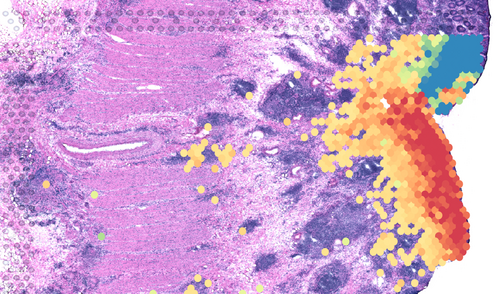 Microscopy image showing intestinal tissue in purple, and red, blue and yellow dots in specific regions