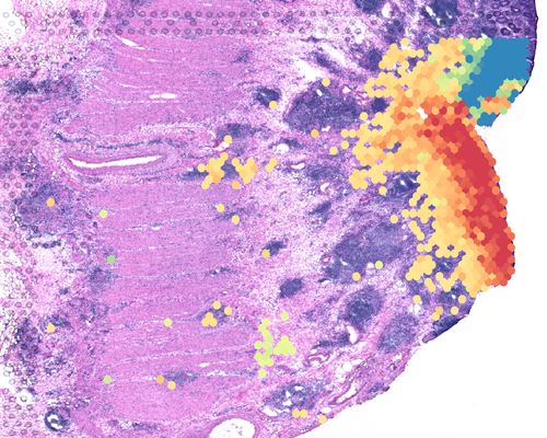 Microscopy image showing intestinal tissue in purple, and red, blue and yellow dots in specific regions