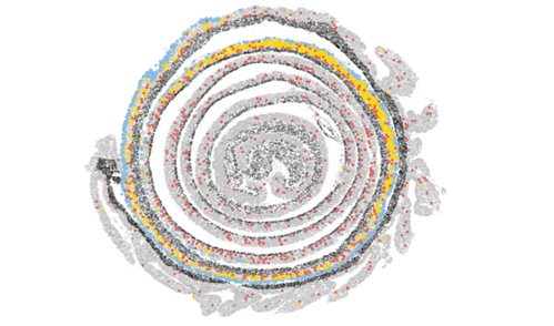 A spatial map of colon tissue with colored dots showing different cell types.