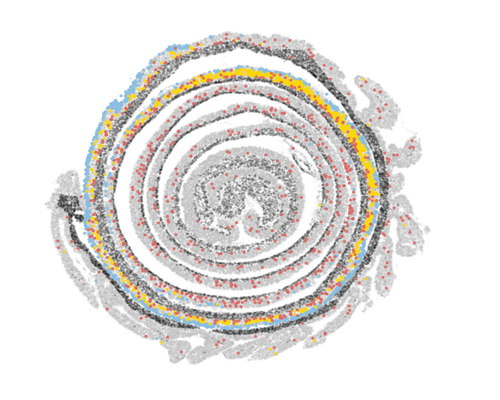 A spatial map of colon tissue with colored dots showing different cell types.