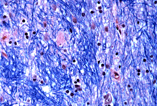 Blue and pink histological image of stained brain tissue.
