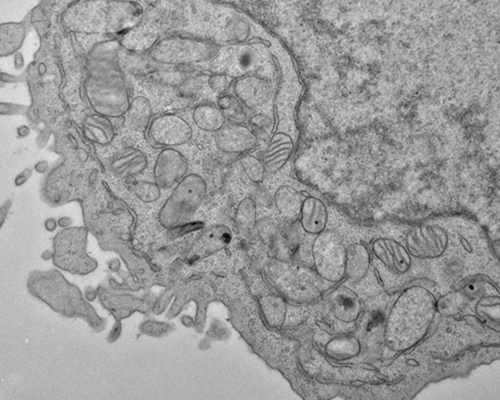 Electron microscopy image of a human hematopoietic stem cell showing hallmarks of ferroptosis, including shrunken mitochondria with fewer inner membrane folds.