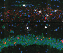 Fluorescence microscopy image of brain tissue from a mouse model of Alzheimer’s, showing tau tangles (red), amyloid plaques (white), RNA (green), and cell nuclei (blue).