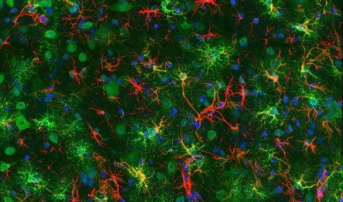 Colorful microscopy image of cells in green, red, and blue.