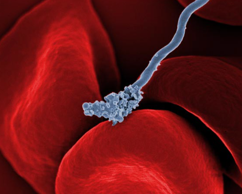Scanning electron micrograph of Borrelia interacting with red blood cells.