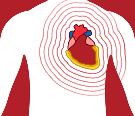 A graphic showing a white outline of a torso on a red background, featuring a smaller inset graphic of the human heart with ripple lines extending around it. 