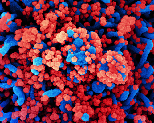 Colorized scanning electron micrograph of a cell (blue) heavily infected with SARS-CoV-2 virus particles (red), isolated from a patient sample. Image captured at the NIAID Integrated Research Facility in Fort Detrick, Maryland.
