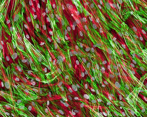 Fibroblasts, a kind of connective tissue cell in the heart, showing cell nuclei (gray), tubulin (red), and actin (green).