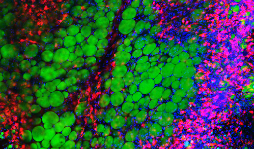 Obesity -  a microscopic view of tissue, showing different cell types and structures within adipose tissue