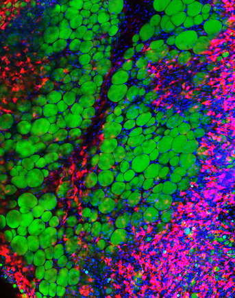 Obesity -  a microscopic view of tissue, showing different cell types and structures within adipose tissue