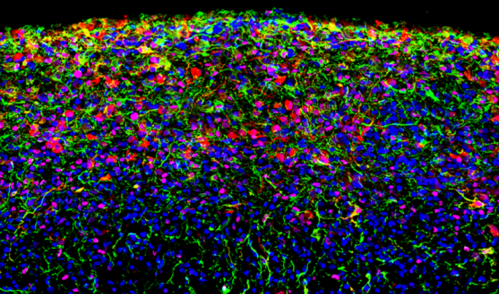 A brain organoid derived from a human induced pluripotent stem cell line and grown in culture for 180 days shows a high level of cell-type diversity, including radial glial cells (magenta) and astrocytes (green and red). Cell nuclei are labelled in blue.
