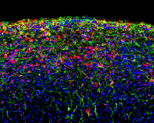 A brain organoid derived from a human induced pluripotent stem cell line and grown in culture for 180 days shows a high level of cell-type diversity, including radial glial cells (magenta) and astrocytes (green and red). Cell nuclei are labelled in blue.