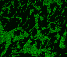 Microscope image of Oscillibacter bacteria that have taken up cholesterol, which is labeled with a fluorescent dye.