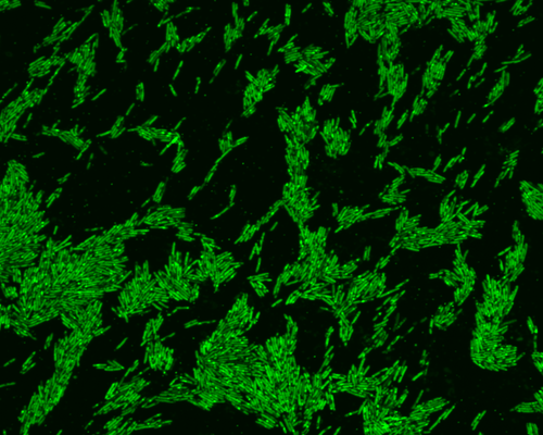 Microscope image of Oscillibacter bacteria that have taken up cholesterol, which is labeled with a fluorescent dye.