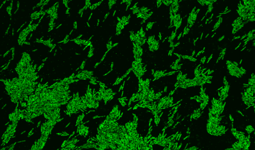 Microscope image of Oscillibacter bacteria that have taken up cholesterol, which is labeled with a fluorescent dye.