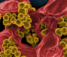Methicillin-resistant Staphylococcus aureus (gold) on the remains of an immune cell (red)
