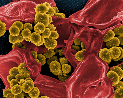 Methicillin-resistant Staphylococcus aureus (gold) on the remains of an immune cell (red)