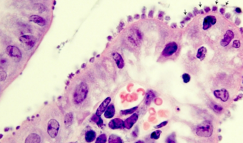 Intestinal tissue infected with Cryptosporidium, with arrows pointing to the parasites.