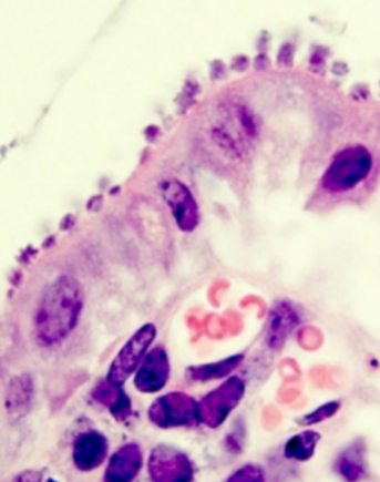Intestinal tissue infected with Cryptosporidium, with arrows pointing to the parasites.