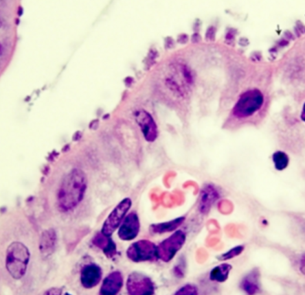 Intestinal tissue infected with Cryptosporidium, with arrows pointing to the parasites.