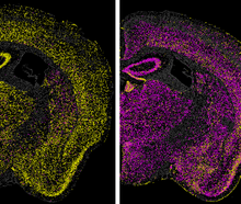 Images of a mouse brain show many yellow dots in the left panel, representing neurons expressing the prion protein. The right panel shows most of those neurons as purple dots, meaning that they no longer expressing the protein after being treated with the CHARM gene-silencing technology.
